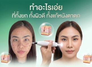 เปิดตัวพลาสมา นวัตกรรมความงามใหม่ล่าสุด จัดการปัญหาผิวหลังการทำเลเซอร์